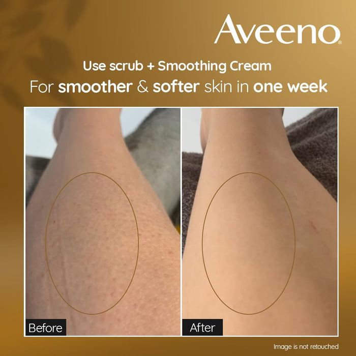 Aveeno Skin Renewal Smoothing Cream - 300ml - Hand & Body Lotion at MyPerfumeShop by Aveeno