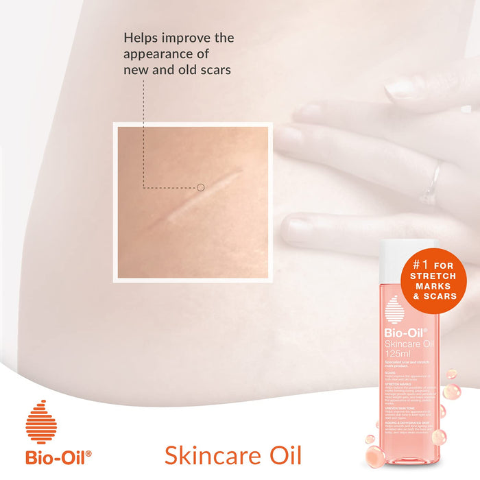 Bio-Oil - 125ml - Hand & Body Lotion at MyPerfumeShop by Bio-Oil