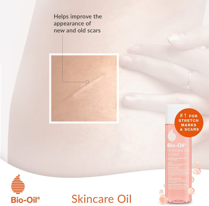 Bio-Oil - 125ml - Hand & Body Lotion at MyPerfumeShop by Bio-Oil